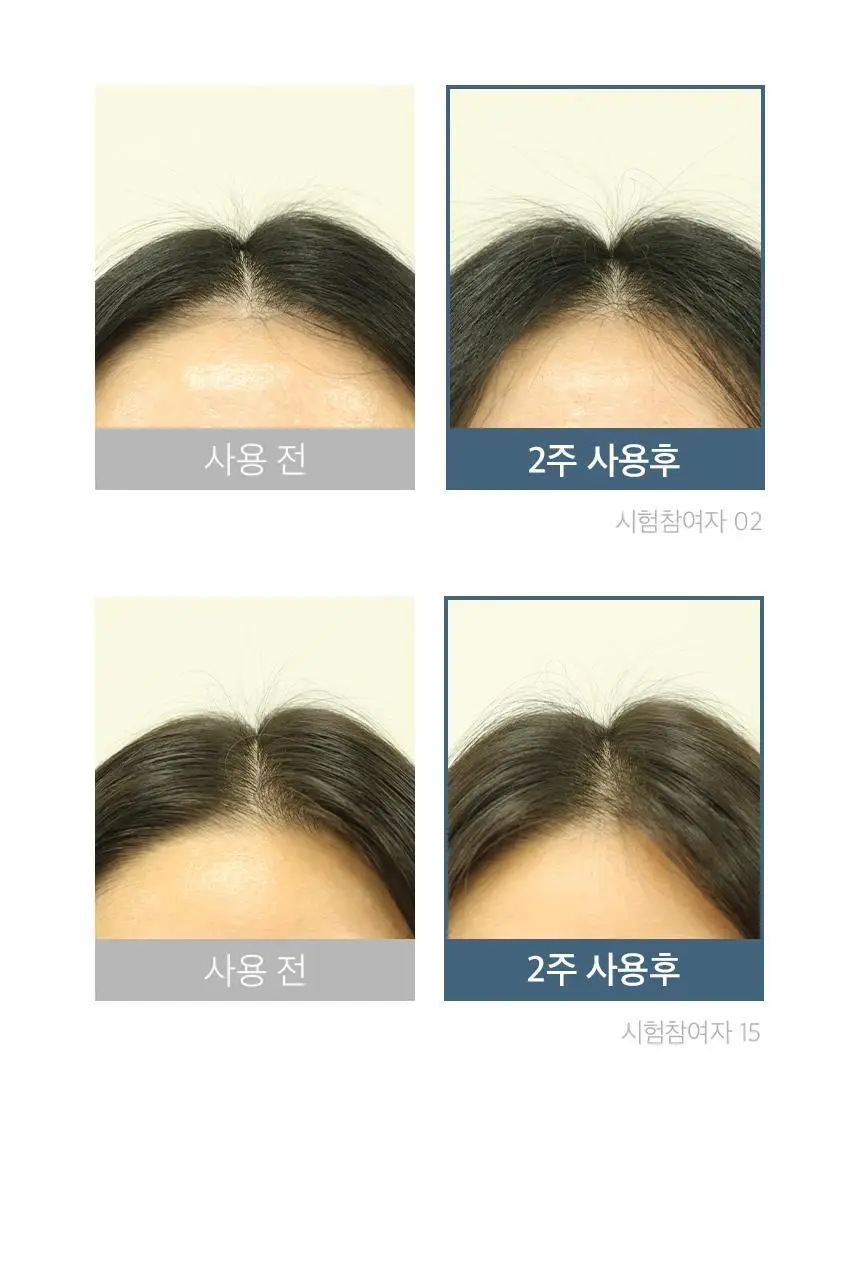 [단독기획] 에퓨놀 바이옴 샴푸 500ml+100ml 기획세트 상세페이지 34